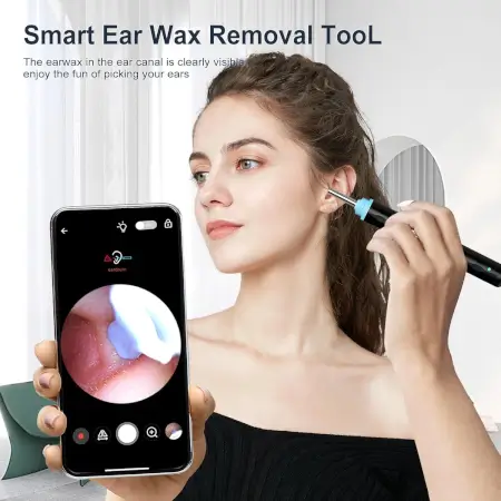 Pu8WkfyyLLoysT00bZwXRFbIq8VuvWsHa43Wbxns.webp Earwax Removal Tool Kit with HD Camera Wifi Connection & 6 LED Lights Endoscope Tool Ear Cleaner for iOS & Android + 11 Silicone Tips Free- Black ( black, Standard )