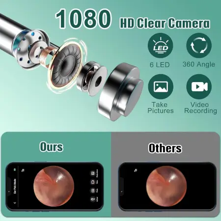 SyMxD6akQreHRLUqCVnLFZ8WXvaLvlQlIw7FBVHT.webp Earwax Removal Tool Kit with HD Camera Wifi Connection & 6 LED Lights Endoscope Tool Ear Cleaner for iOS & Android + 11 Silicone Tips Free- Black ( black, Standard )